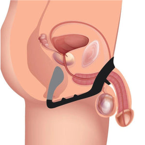 Master Series Prostatic Play Excursion Silicone Triple Stimulator Anal Plug with Cock and Ball Ring buy in Singapore LoveisLove U4ria